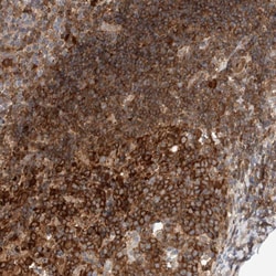 Invitrogen NFkB p100 Polyclonal Antibody 100 &mu;L; Unconjugated:Antibodies,
