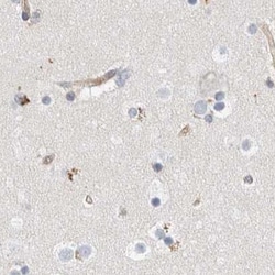 Invitrogen NFkB p100 Polyclonal Antibody 100 &mu;L; Unconjugated:Antibodies,