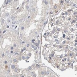 Invitrogen NFkB p100 Polyclonal Antibody 100 &mu;L; Unconjugated:Antibodies,