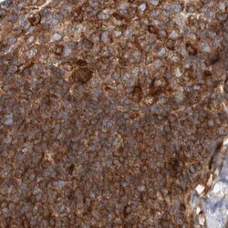 Invitrogen NFkB p100 Polyclonal Antibody 100 &mu;L; Unconjugated:Antibodies,