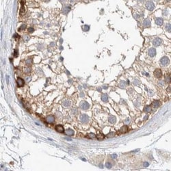Invitrogen NFkB p100 Polyclonal Antibody 100 &mu;L; Unconjugated:Antibodies,