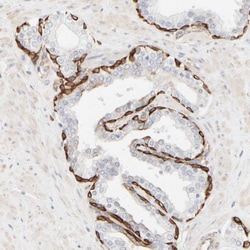 Invitrogen Cytokeratin 15 Polyclonal Antibody 100 &mu;L; Unconjugated:Antibodies,