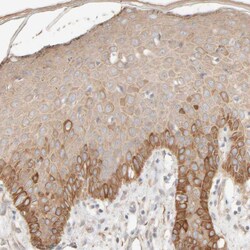 Invitrogen Cytokeratin 15 Polyclonal Antibody 100 &mu;L; Unconjugated:Antibodies,