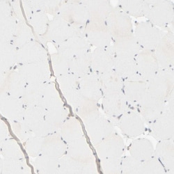 Invitrogen Cytokeratin 15 Polyclonal Antibody 100 &mu;L; Unconjugated:Antibodies,