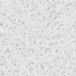 Invitrogen Cytokeratin 15 Polyclonal Antibody 100 &mu;L; Unconjugated:Antibodies,