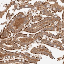 Invitrogen p40 Polyclonal Antibody 100 &mu;L; Unconjugated:Antibodies,