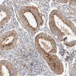 Invitrogen p40 Polyclonal Antibody 100 &mu;L; Unconjugated:Antibodies,