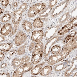Invitrogen p40 Polyclonal Antibody 100 &mu;L; Unconjugated:Antibodies,