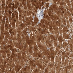 Invitrogen Arginase 1 Polyclonal Antibody 100 &mu;L | Buy Online | Invitrogen&trade; | Fisher Scientific
