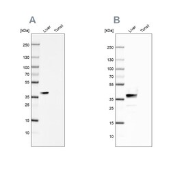 Invitrogen Arginase 1 Polyclonal Antibody 100 &mu;L | Buy Online | Invitrogen&trade; | Fisher Scientific