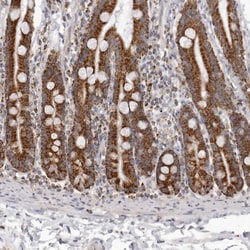 Invitrogen TUFM Polyclonal Antibody 100 &mu;L; Unconjugated:Antibodies,