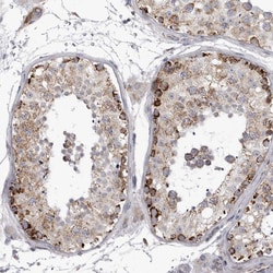 Invitrogen TUFM Polyclonal Antibody 100 &mu;L; Unconjugated:Antibodies,