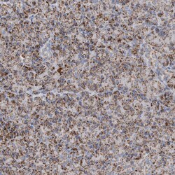 Invitrogen ETFA Polyclonal Antibody 100 &mu;L; Unconjugated:Antibodies,