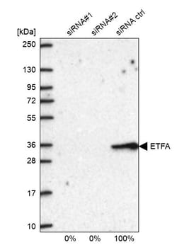 Invitrogen ETFA Polyclonal Antibody 100 &mu;L; Unconjugated:Antibodies,