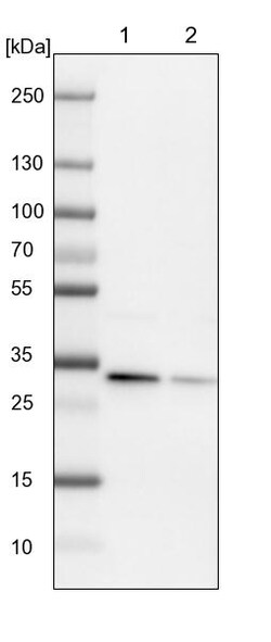 Invitrogen ETFA Polyclonal Antibody 100 &mu;L; Unconjugated:Antibodies,