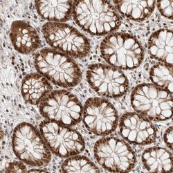 Invitrogen TSPAN32 Polyclonal Antibody 100 &mu;L; Unconjugated:Antibodies,