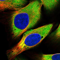 Invitrogen USP25 Polyclonal Antibody 100 &mu;L; Unconjugated:Antibodies,