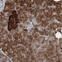 Invitrogen USP25 Polyclonal Antibody 100 &mu;L; Unconjugated:Antibodies,