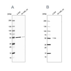 Invitrogen GPI Polyclonal Antibody 100 &mu;L | Buy Online | Invitrogen&trade; | Fisher Scientific