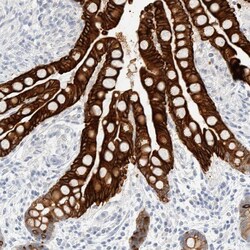 Invitrogen Cytokeratin 20 Polyclonal Antibody 100 &mu;L; Unconjugated:Antibodies,