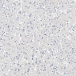 Invitrogen Cytokeratin 20 Polyclonal Antibody 100 &mu;L; Unconjugated:Antibodies,
