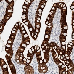 Invitrogen Cytokeratin 20 Polyclonal Antibody 100 &mu;L; Unconjugated:Antibodies,