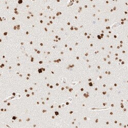 Invitrogen ZNF447 Polyclonal Antibody 100 &mu;L; Unconjugated:Antibodies,