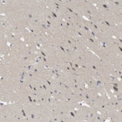 Invitrogen NFATC2 Polyclonal Antibody 100 &mu;L; Unconjugated:Antibodies,