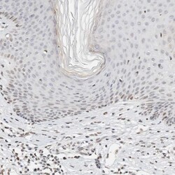 Invitrogen SPT3 Polyclonal Antibody 100 &mu;L; Unconjugated:Antibodies,