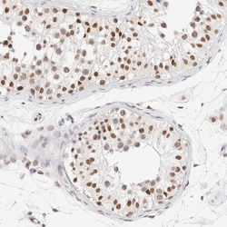 Invitrogen SPT3 Polyclonal Antibody 100 &mu;L; Unconjugated:Antibodies,