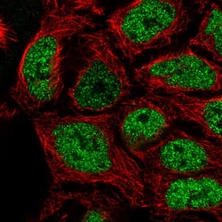 Invitrogen SP6 Polyclonal Antibody 100 &mu;L; Unconjugated:Antibodies,