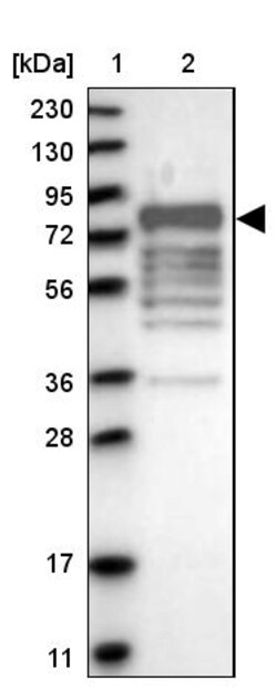 Invitrogen MARK3 Polyclonal Antibody 100 &mu;L; Unconjugated:Antibodies,