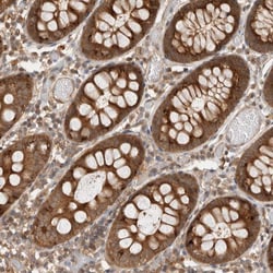 Invitrogen VPS28 Polyclonal Antibody 100 &mu;L; Unconjugated:Antibodies,