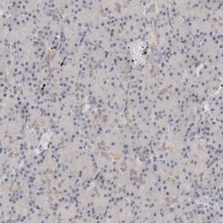 Invitrogen VPS28 Polyclonal Antibody 100 &mu;L; Unconjugated:Antibodies,