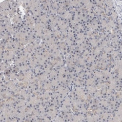 Invitrogen VPS28 Polyclonal Antibody 100 &mu;L; Unconjugated:Antibodies,
