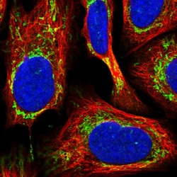 Invitrogen Fumarase Polyclonal Antibody 100 &mu;L; Unconjugated:Antibodies,