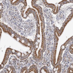 Invitrogen Fumarase Polyclonal Antibody 100 &mu;L; Unconjugated:Antibodies,