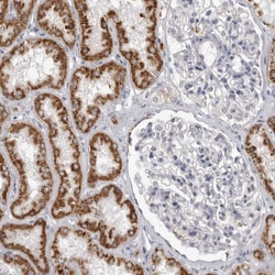 Invitrogen Fumarase Polyclonal Antibody 100 &mu;L; Unconjugated:Antibodies,