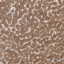 Invitrogen Fumarase Polyclonal Antibody 100 &mu;L; Unconjugated:Antibodies,