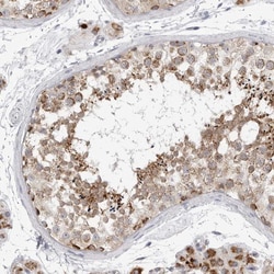 Invitrogen Fumarase Polyclonal Antibody 100 &mu;L; Unconjugated:Antibodies,