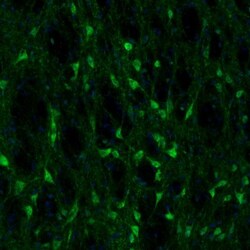 Invitrogen Fumarase Polyclonal Antibody 100 &mu;L; Unconjugated:Antibodies,
