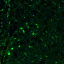 Invitrogen Fumarase Polyclonal Antibody 100 &mu;L; Unconjugated:Antibodies,
