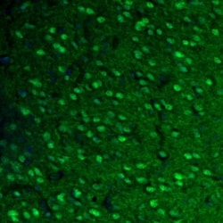 Invitrogen Fumarase Polyclonal Antibody 100 &mu;L; Unconjugated:Antibodies,