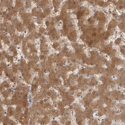Invitrogen ACAT2 Polyclonal Antibody 100 &mu;L; Unconjugated:Antibodies,