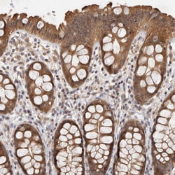 Invitrogen ACAT2 Polyclonal Antibody 100 &mu;L; Unconjugated:Antibodies,