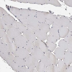 Invitrogen ACAT2 Polyclonal Antibody 100 &mu;L; Unconjugated:Antibodies,