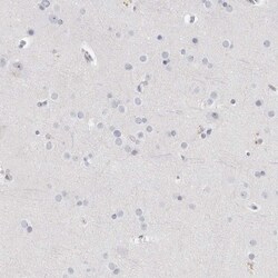 Invitrogen ThPOK Polyclonal Antibody 100 &mu;L; Unconjugated:Antibodies,