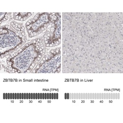 Invitrogen ThPOK Polyclonal Antibody 100 &mu;L | Buy Online | Invitrogen&trade; | Fisher Scientific