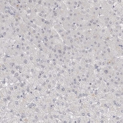 Invitrogen ThPOK Polyclonal Antibody 100 &mu;L; Unconjugated:Antibodies,