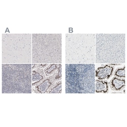 Invitrogen ThPOK Polyclonal Antibody 100 &mu;L | Buy Online | Invitrogen&trade; | Fisher Scientific